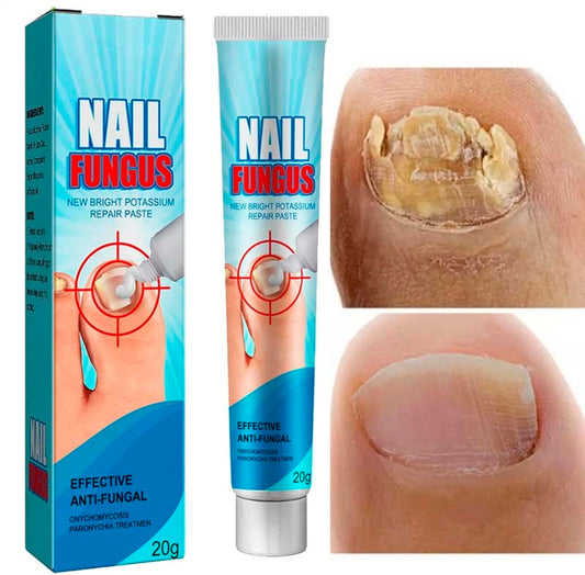 REPARADOR DE UÑAS | QUITA HONGOS EN DÍAS